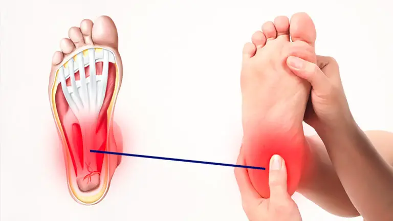 What is plantar fasciitis? Treatment: physical therapy, surgery, symptoms, and more…